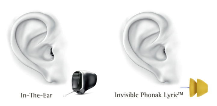 In-The-Ear-Hearing-Aids