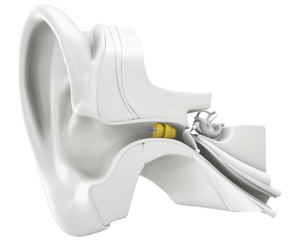 lyric-in-ear diagram