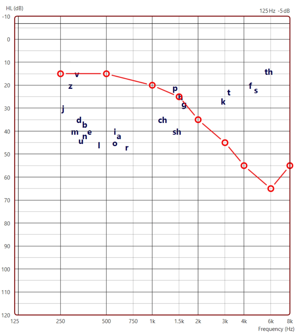 audiogram graph audiogram